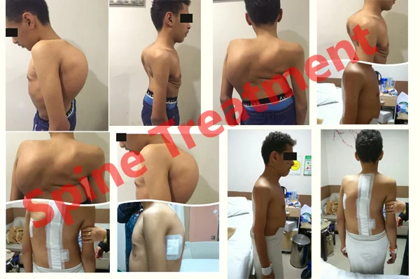 Patient Story 1